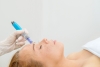 Microneedling for Hyperpigmentation Treatment