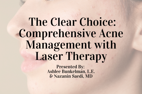 Webinar: The Clear Choice: Comprehensive Acne Management with Laser Therapy