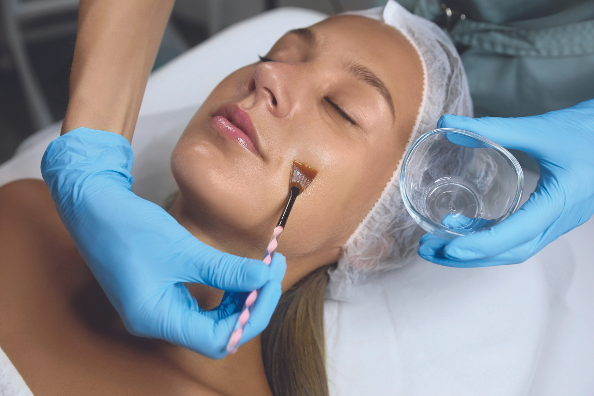 Chemical Peels: An Alternate Perspective 